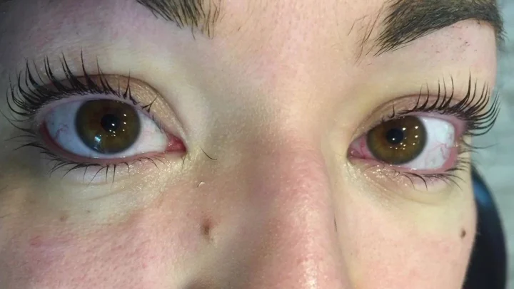 Brown eyes after a lash lift, curl visible